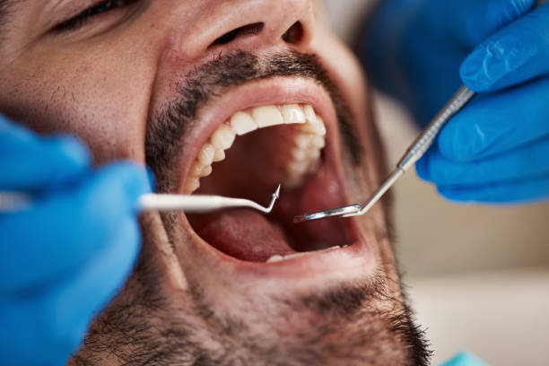 Best Cracked Tooth Emergency Dentist  in Cowarts, AL